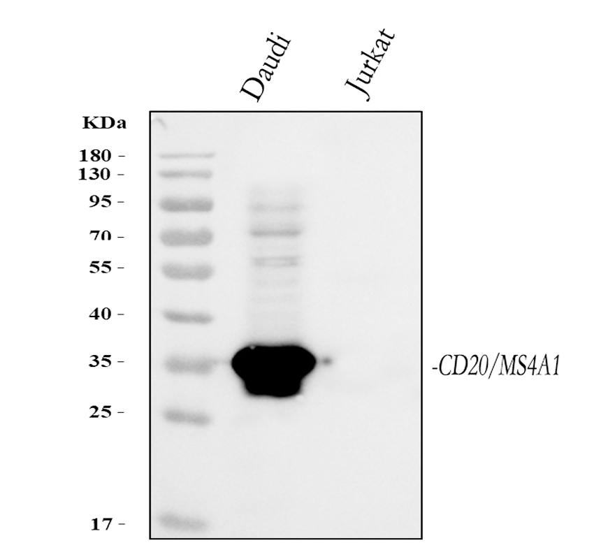 Daudi and Jurkat cells